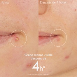CAUDALIE STOP GRANOS 15ML