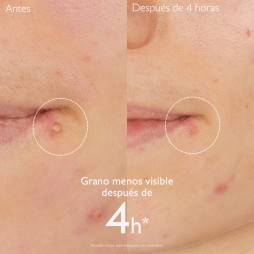CAUDALIE STOP GRANOS 15ML